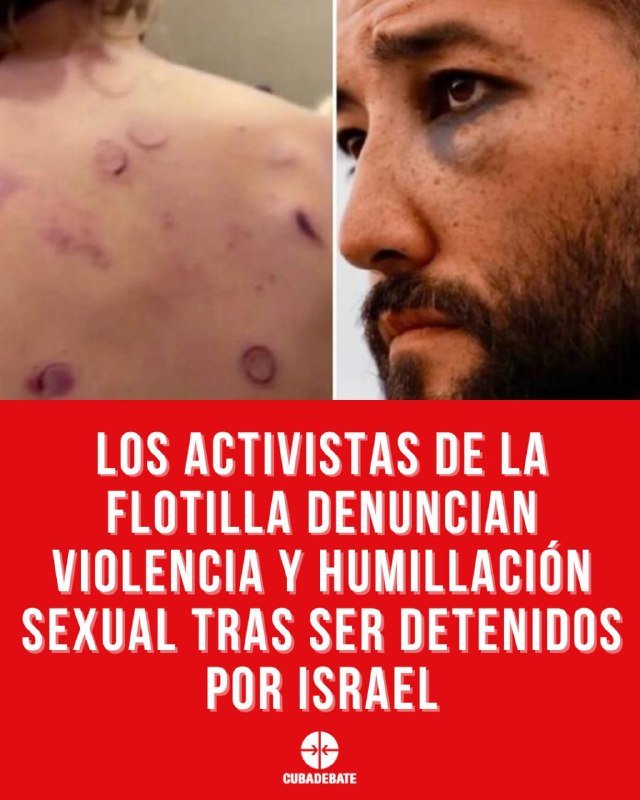 Split image showing circular welts on a bare back beside a bearded man's face, above Spanish text claiming flotilla activists reported violence after Israeli detention, with a Cubadebate logo.