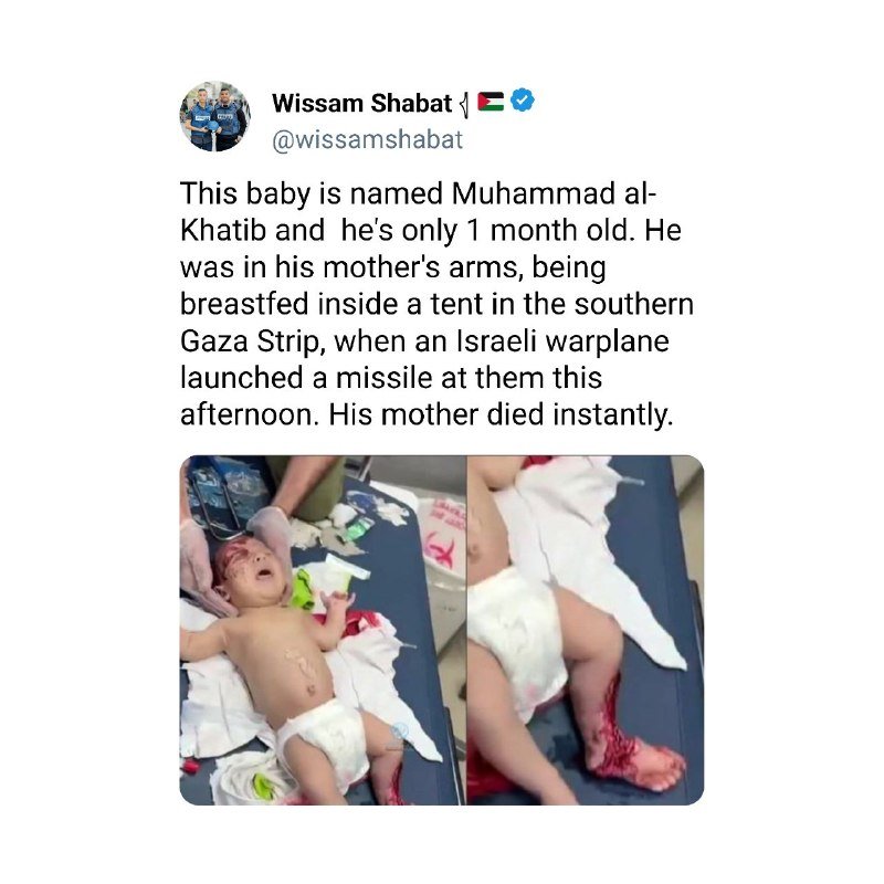 A crying infant in a diaper lies on a medical surface with visible injuries, treated by a gloved hand, while an adjacent image shows the child's bloodied leg.