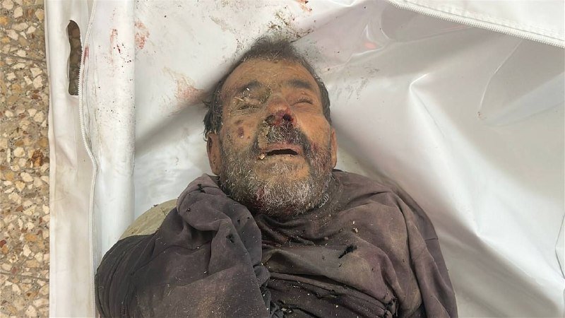A bearded man lies on a white body bag on a pebbled surface, his face and dark clothing covered in dirt and blood with visible facial injuries.