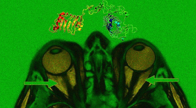 A medical imaging composite displays a green-tinted brain scan with two circular eye markers and green arrows overlaid on colorful molecular structures at the top.