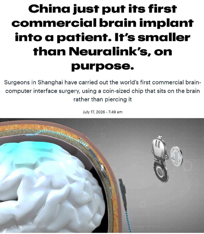 A digital illustration shows a light-blue brain beneath a glowing skull cap, with a small coin-sized chip and surgical device displayed to the side.