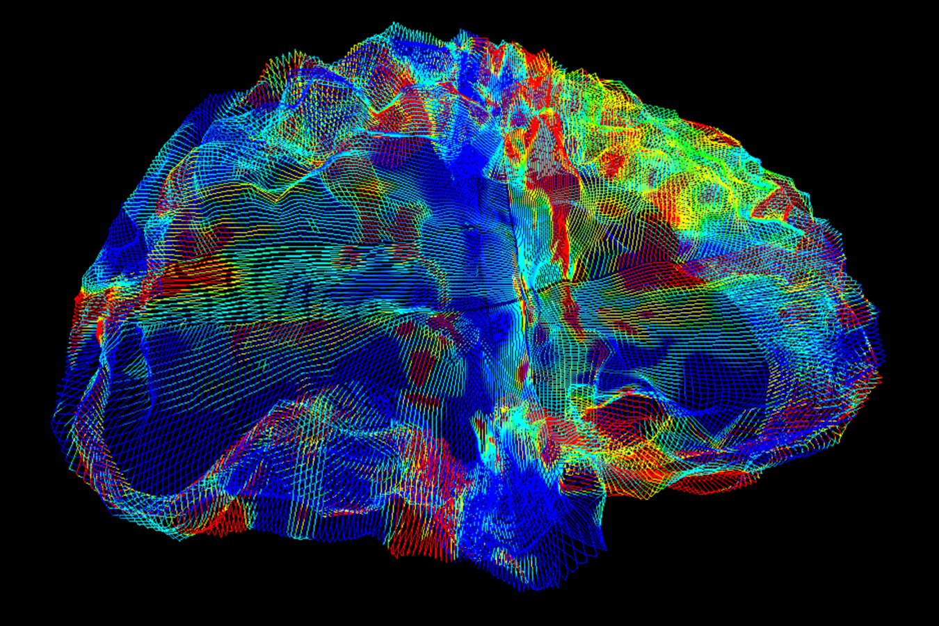 Antibody-based Alzheimer’s therapies are being re-engineered to enter the brain more efficiently.